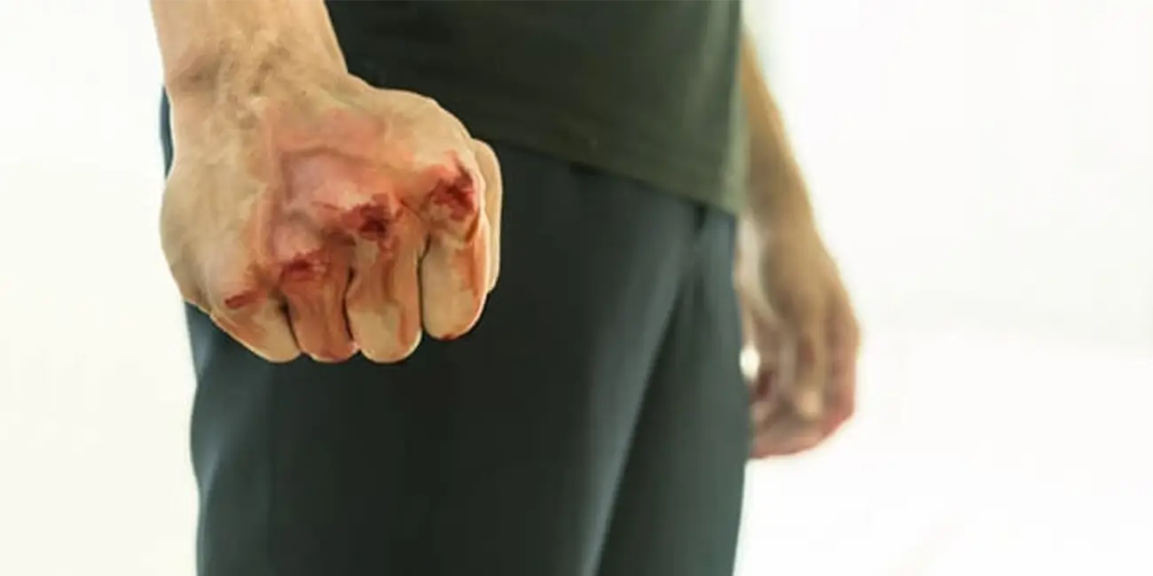 transtorno-da-personalidade-antissocial